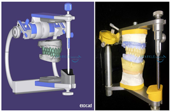 CAD/CAM DENTISTRY